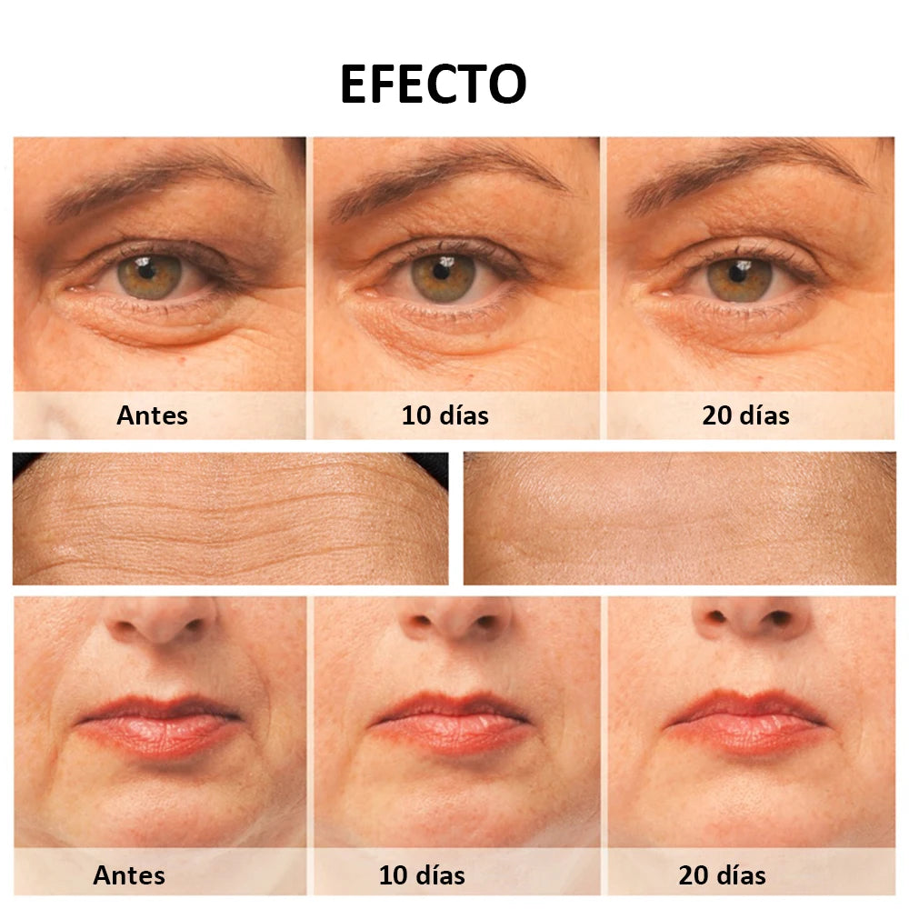 Masajeador De Radiofrecuencia Facial Anti-arrugas | 50% Descuento + Envío Gratis