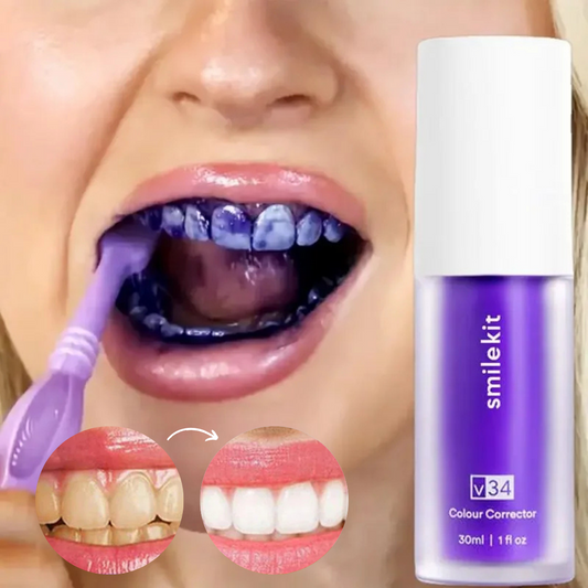 HISMILE - CORRECTOR DE COLOR DENTAL | 50% DE DESCUENTO + ENVÍO GRATIS