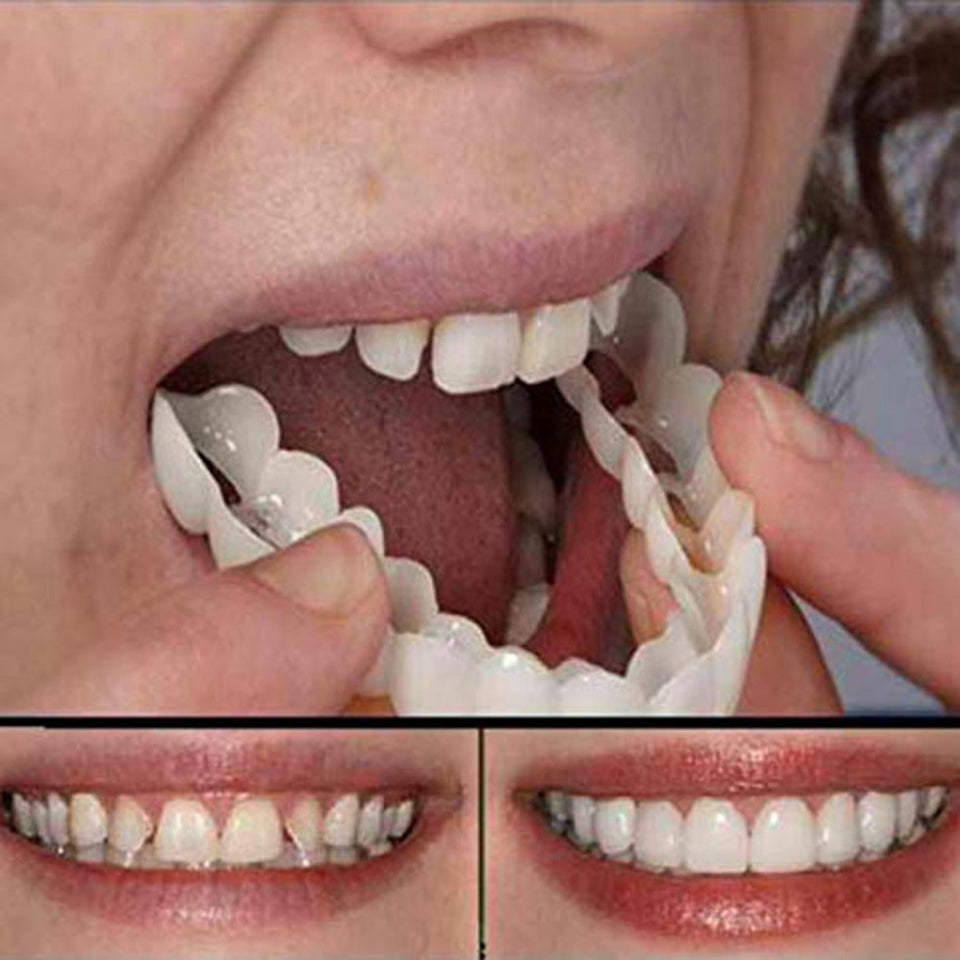 SNAP ON SMILE™ CARILLAS DENTALES AJUSTABLES